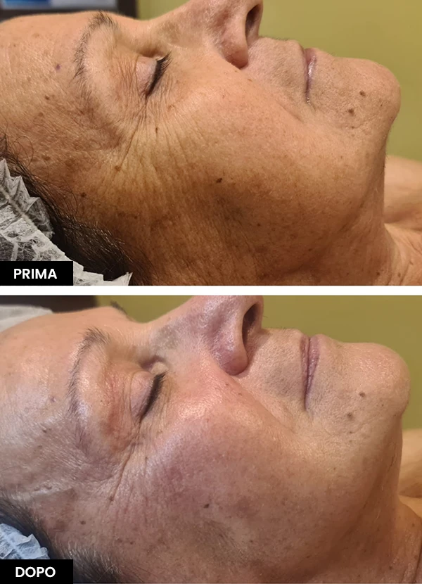 trattamenti-viso-2